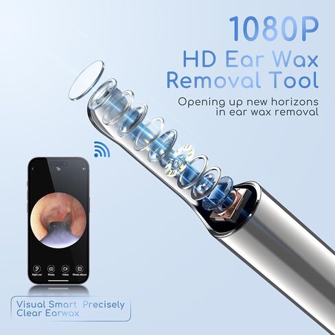 Earwax Removal - Electric Ear Irrigation Kit with 4 Pressure Modes, Ear Cleaner with Camera, 1080P Otoscope, Ear Cleaning Tool with 7-Piece Set, Earwax Removal Kit for Daily Cleaning(White) in Saudi Arabia