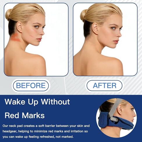 Neck Pad for Headgear Straps, Comfortable Fleece CPAP Headgear Strap Covers Universal and Washable CPAP Mask Cushions Can Reduce Headgear Pressure and Cheek Red Marks, Blue in Saudi Arabia