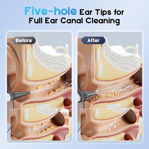 Ear Wax Removal, Electric Ear Cleaning Kit with Light, Ear Irrigation Kit with 4 Pressure Modes, Safe and Effective Ear Flush Kit with Ear Cleaner - Includes Basin, Towel & 12 Tips, (White) in Saudi Arabia