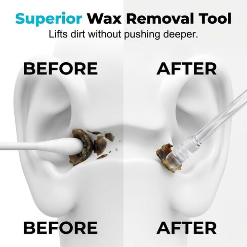 Sticky Ear Cleaning Stick for Adults, 2026 New Reusable Sticky Ear Cleaner Picks, Removal Adhesive Swabs Gentle Soft Ear Scoop Remover Tool with Dust Cover Packaging (24pcs, Small) in Kuwait
