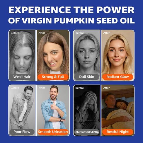Pumpkin Seed Oil Gummies with Saw Palmetto + Omega-3, Zinc, Vitamins A, C & E - Essential Fatty Acid, Cold Pressed Pumpkin Seed Oil for Hair Growth, Skin, Prostate, Urinary & Bladder, 60-Days Supply in Kuwait