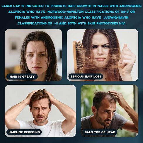 Wireless Rechargeable Red Light Therapy for Hair Growth – FDA Cleared Laser Cap for Hair Regrowth. Treats Hair Loss, Thinning & Alopecia for Men & Women in Saudi Arabia