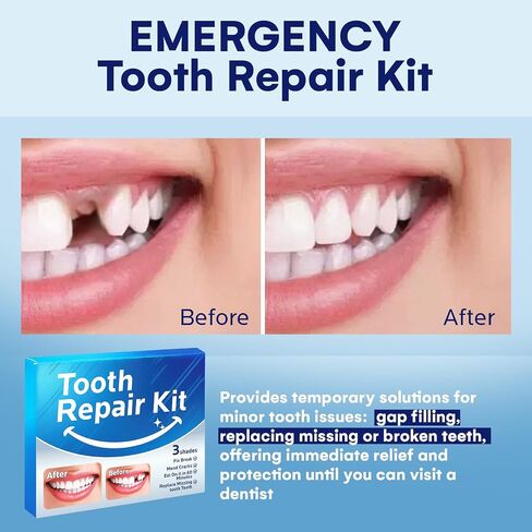 Temporary Tooth Repair Kit: Missing Tooth Replacement Kit Replace Missing or Broken Tooth Filling The Gap - Moldable False Teeth Come with 3 Shades 10 Size in Kuwait