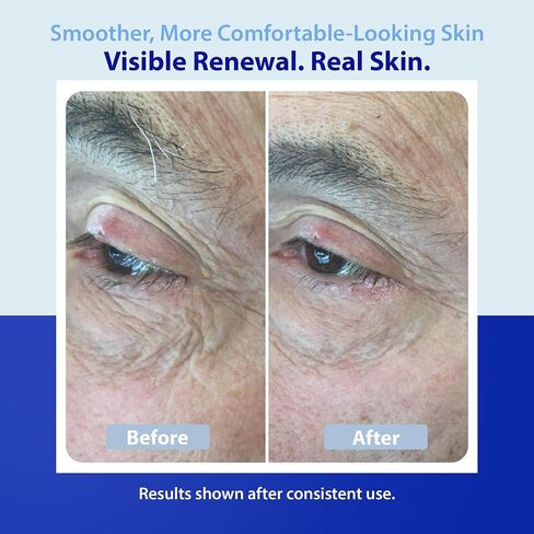 Dr. Denese SkinScience Firming Facial MicroDermabrasion Cream Refresh with Botanical Ingredients - Dual Physical Peel & Chemical Exfoliant For Glowing Radiant Skin - Paraben-Free, Cruelty-Free - 6oz in Kuwait