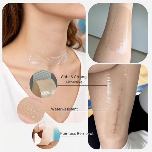 Silicone Scar Sheets 0.4mm Thick, Medical Grade Silicone Scar Tape Roll 1.6" x 120" (2 Rolls), Reusable Scar Sheets for Surgical Scars, C Section, Keloid, Burn, Acne & Scar Removal Treatment in Saudi Arabia