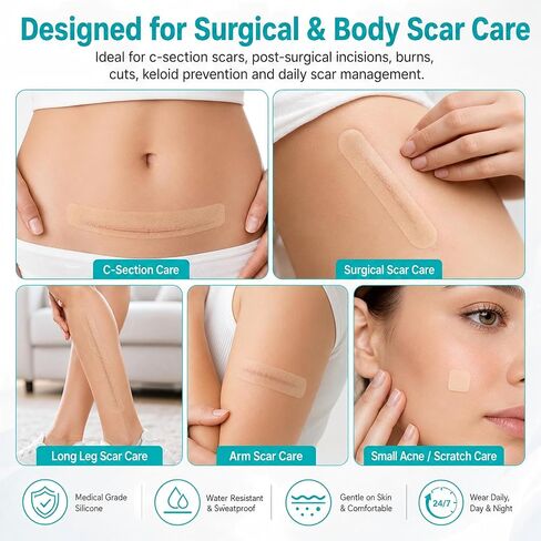 Silicone Scar Sheets 0.4mm Thick, Medical Grade Silicone Scar Tape Roll 1.6" x 120" (2 Rolls), Reusable Scar Sheets for Surgical Scars, C Section, Keloid, Burn, Acne & Scar Removal Treatment in Saudi Arabia