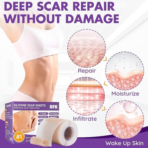 Silicone Scar Sheets, Silicone Scar Tape(1.6"x 118" Roll-3M), Reusable Professional Scar Silicone Strips, Soft Silicone Scar Sheets for Surgical Scars,Keloid,Acne Scars,Burn Scar,C-Section in Saudi Arabia
