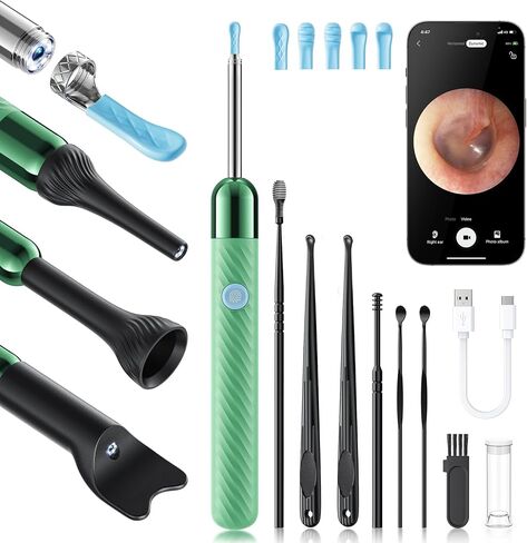 Loyker X6 Ear Wax Removal Tool Camera, Ear Cleaner with Camera, FSA - HSA Store Eligible, 1080P Ear Camera with 6LED Light for Ear/Nose/Throat/Tonsil Stone Examination, Black in Saudi Arabia