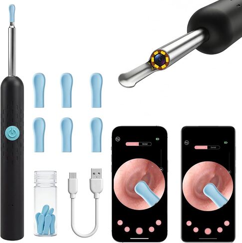 Wireless Ear Wax Removal Tool Camera, HD Ear Cleaner with Camera and Light, Smart Otoscope Ear Cleaning Kit with Silicone Ear Spoons, Ear Wax Cleaner & Ear Pick for Adults and Kids, FSA HSA Eligible in Saudi Arabia