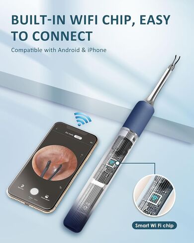 CozyZen S5 Ear Wax Removal Tool with 10 MP Camera, Omnidirectional Tweezers, 1080P HD Otoscope, 12 Ear Spoons, Wireless Ear Cleaner for iOS & Android with Light & Portable Case in Saudi Arabia