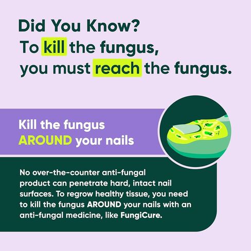 FungiCure Anti-Fungal Night Cream, Cures & Soothes, Clotrimazole 1%, 1.7 oz in Saudi Arabia