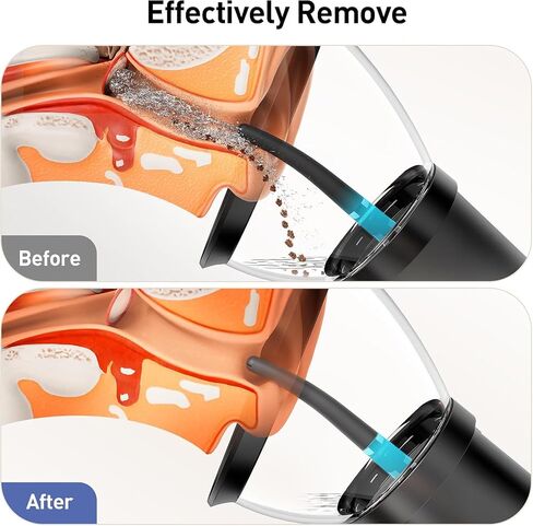 Ear Wax Removal Kit, Electric Ear Cleaner with Ear Irrigation Flushing System, IPX7 Waterproof Ear Cleaning Tool, Automatic Ear Cleaner Earwax Removal for Adults Home Gifts in Kuwait