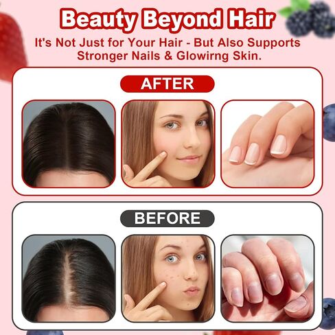 Lumin Hair Growth Gummies – Daily Hair Nourishment with Biotin, Collagen & Botanical Extracts – Supports Thicker, Stronger & Healthier-Looking Hair – Mixed Berry Flavor, 60 Gummies in Kuwait