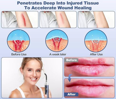 Infrared Red Light Therapy Device for Joints & Muscles Pain Relief, 460:630:660:850:900nm Cold Sore Canker Fever Treat, Portable Near Infrared Wand for Face & Body Mouth Nose Effective 2 in 1 Modes in Saudi Arabia