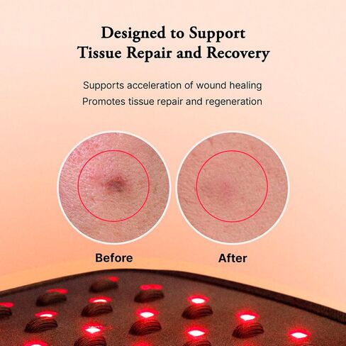 Capillus Body Red Light Therapy Wrap - 2 in 1 LED Cordless Red Light Therapy Belt - Wearable 630nm & 850nm Infrared Red Light Therapy for Back, Waist, Knee, Legs, Shoulder Pain in Saudi Arabia