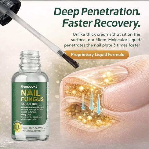 Toenail Fungus Treatment Extra Strength【Max Strength Tea Tree Oil & Undecylenic Acid】Fungus Nail Treatment Liquid Maximum Strength【3-Day Fast Relief】Antifungal Foot & Toe Nail Repair Drops in Kuwait