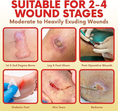 ضمادة إسفنجية من السيليكون من HEALQU بحدود 7x7 بوصة، صندوق مكون من 10 قطع - للعناية المثالية بالجروح - متعددة الطبقات فائقة الامتصاص وسادات مقاومة للماء لاصقة للبشرة قابلة للتنفس للحروق وقرح الضغط. in Kuwait