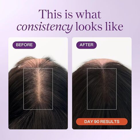 KeraLush Hair Vitamins for Women | Supports Healthy Thick Hair & Volume, Strong Roots, Scalp Care | Biotin, Patented Keratin, Ashwagandha, Vitamin B5, Protects from Pollutants | 30 Servings in Saudi Arabia
