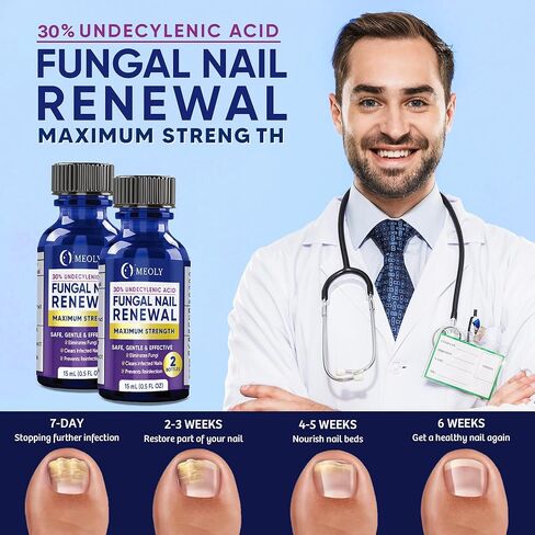 MEOLY Toenail Fungus Treatment Extra Strength: 30% Undecylenic Acid Toenail Fungus Treatment With natural oils -nail bandage, Toenail file & brush 30 ml in Saudi Arabia