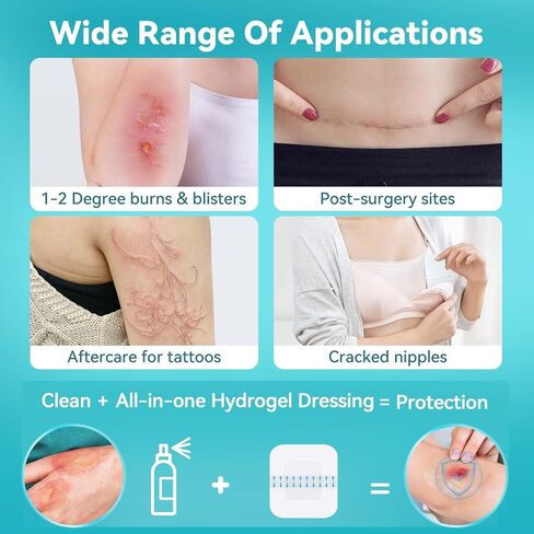 Dimora Hydrogel Burn Pads with Border 6" x 6" (4" x 4" Pad) – Sterile Burn & Wound Dressing with Instant Cooling Relief for Minor Burns, Cuts & Abrasions, Soothing Moist Waterproof Bandages (5 Count) in Saudi Arabia