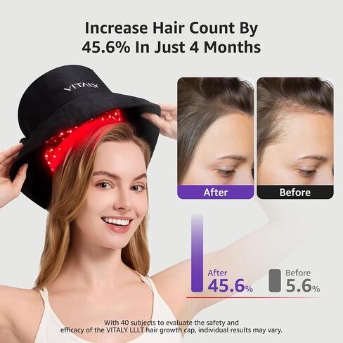 Red Light Therapy for Hair Growth, Red Light Cap for Hair Regrowth in Saudi Arabia