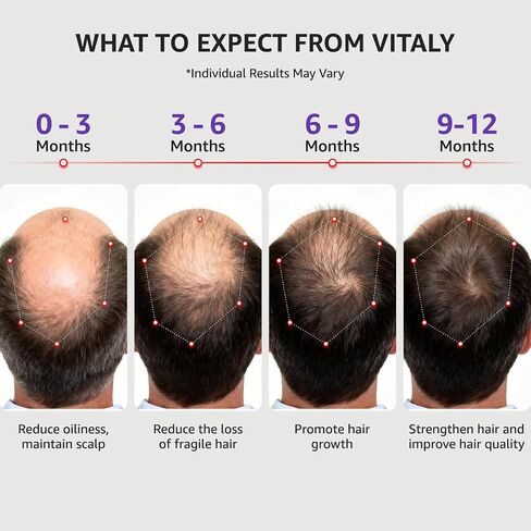 Red Light Therapy for Hair Growth, Red Light Cap for Hair Regrowth in Saudi Arabia