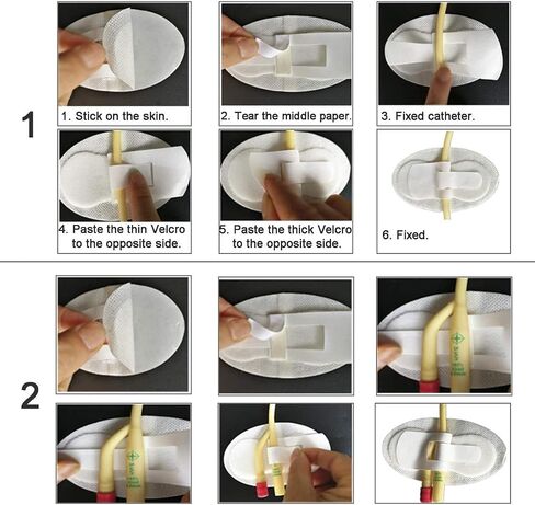 Foley Catheter Urinary Leg Bag Legband Holder,statlock Foley Catheter stabilization Device ，g Tube Accessories Supplies，Feeding Tube Supplies(Pack of 4) in Saudi Arabia