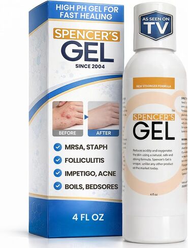 Spencer's Gel Alkaline Formula (4 oz) - lab-Certified to Kill Staph aureus on Skin Contact in Kuwait