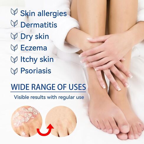2PCS-Herbal Calming Balm for Dry Skin, Intensive Moisturizing Cream with Aloe Vera & Sophora Extract, Soothing Care for Irritated Skin on Hands, Feet, Lower Body & More, Gentle Formula, 1.42 oz in Kuwait
