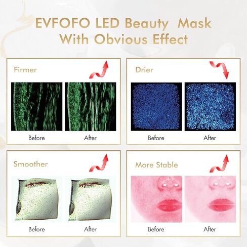 EVFOFO Red Light Therapy Mask for Face, 7 Custom Modes with 850nm NIR & 630nm Red Light, Portable LED Face Mask Light Therapy with Timer for Home Use, White in Saudi Arabia