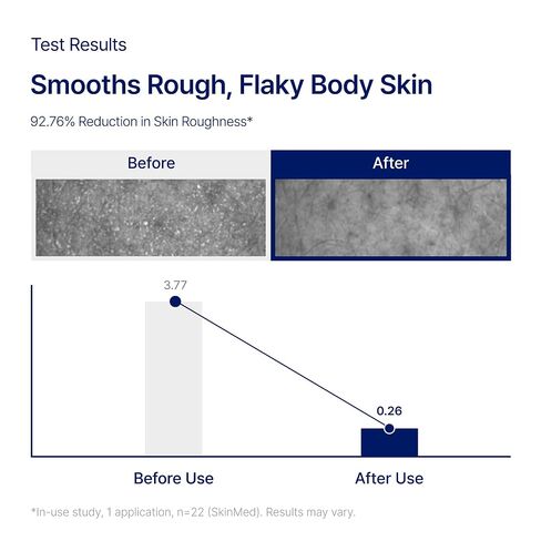 Biorga Back & Body Clear Mist, Leave-On Exfoliating Body Spray with Niacinamide BHA & Centella, Smooths Rough Bumpy Skin, Dark Spots & Uneven Tone on Back Chest Shoulders, Korean Skincare, 6.76 fl oz in Kuwait