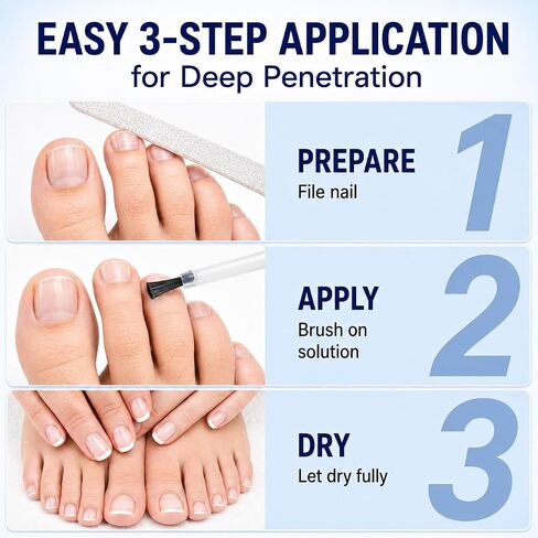 Nail Fungus Treatment Extra Strength: 25% Undecylenic Acid Formula – Toenail Fungus Treatment Kit with Brush & File for Ingrown Nails, Discoloration & Brittle Nails, Thick-Looking, Rough-Looking in Saudi Arabia