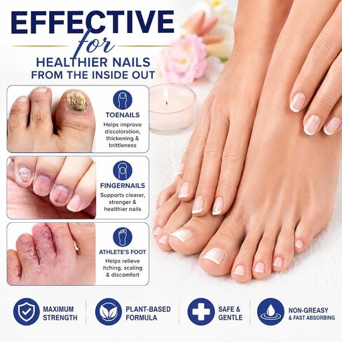Nail Fungus Treatment Extra Strength: 25% Undecylenic Acid Formula – Toenail Fungus Treatment Kit with Brush & File for Ingrown Nails, Discoloration & Brittle Nails, Thick-Looking, Rough-Looking in Saudi Arabia