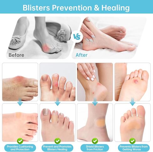 30ct Gel Blister Bandages, Hydrocolloid Bandages for Feet, Waterproof Adhesive Blisters Bandages Pads for Heel, Toe, Blister Cushion for Prevention & Recovery in Saudi Arabia