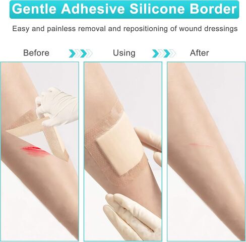 Silicone Foam Dressing 4"x4"(10 Pack) with Adhesive Border, Wound Care Dressings Highly Absorbent Large Waterproof Silicone Bandages for Pressure Ulcers, Bedsores, Leg Ulcers in Saudi Arabia