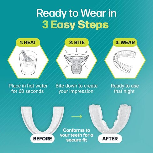 Dental Guard – Custom-Fit Mouth Guard for Grinding Teeth at Night – Slim Night Mouth Guards for Sleeping with Jaw Comfort – Easy & Secure Fit for Nighttime Enamel Protection (Clear, 1 Count) in Kuwait