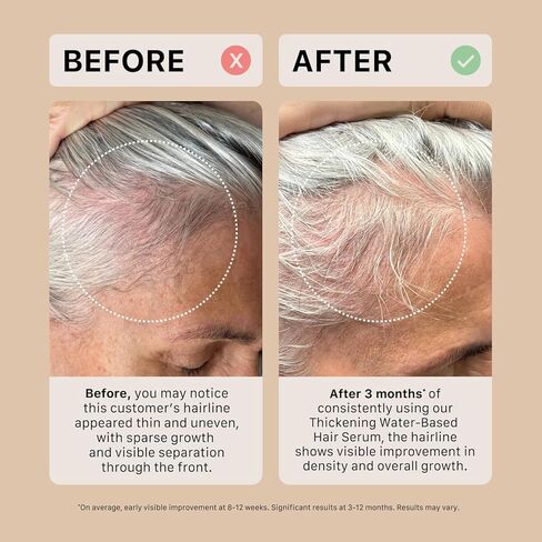 ACTIIV Thickening Hair Serum - Water Based | Supports the Appearance of Thicker, Fuller-Looking Hair, Lightweight Water-Based Formula, Non-Greasy, All Hair Types, 1.8 oz in Kuwait