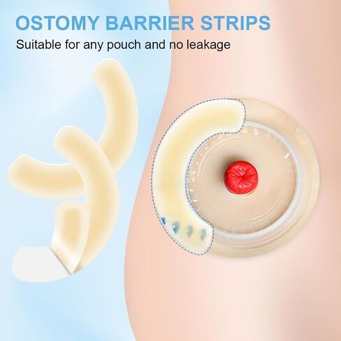 Ostomy Barrier Strips 15pcs Elastic Ostomy Barrier Strip Hydrocolloid Skin Barrier Tape Universal Ostomy Supplies for Colostomy Ileostomy Bags Pouches in Saudi Arabia