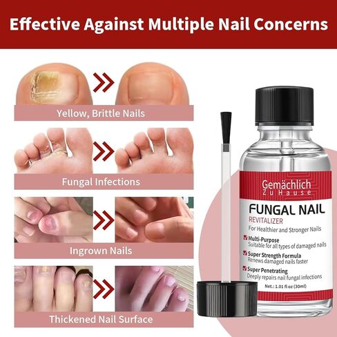 علاج فطريات أظافر قوة إضافية ، علاج فطريات الأظافر مع حمض undecylenic للأظافر والأظافر ، إصلاح الأظافر المضاد للفطريات للرياضيين ، نام ، سميكة ، مكسورة ، أظافر تالفة ، 30 مل ل. in Kuwait