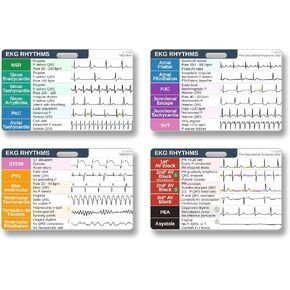 مجموعة بطاقات تفسير إيقاع EKG، مرجع ورقة الغش لإيقاع EKG للممرضات وأطباء الطوارئ والمسعفين الطبيين وطلاب الطب - شارة مقاومة للماء على الوجهين مع 24 إيقاعًا شائعًا للقلب in Kuwait
