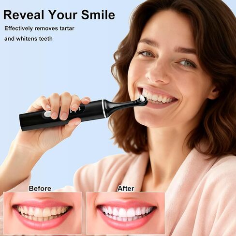 YOFOTHS Tooth Polisher, Rechargeable Teeth Polisher for Daily Cleaning, Whitening and Polishing, Electric Dental Teeth Polishing with LED Light, 6 Brush Heads, 5 Speed Modes, Waterproof in Kuwait