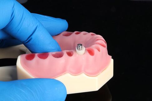 Emergence Profile Silicone Index Organizer Block – Dental Implant Natural Emergence Profiler, Autoclave Safe, Universal Compatibility in Kuwait