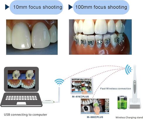 Dental Intraoral Camera Wireless, Auto-Focus Dental Camera, Wireless Charging, 13MP HD Intraoral Dental Imaging Scope Works with Most Dental Imaging Software in Kuwait