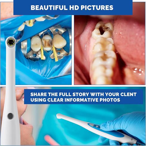 كاميرات طب الأسنان داخل الفم JMU، كاميرا طب الأسنان USB عالية الدقة 720P in Kuwait