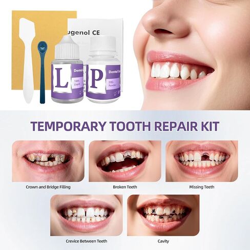 Tooth Repair Kit, Zinc Oxide Eugenol Cement for Cavities Filling, Dental Care Kit for Broken, Chipped or Missing Teeth, Temporary and Permanent Tooth Filling and Crown Fixing at Home in Kuwait