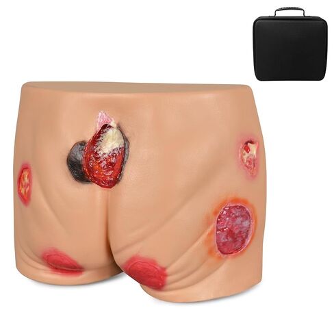 PVC Buttock Decubitus Ulcer Model, Pressure Ulcer Wound Care Model, Wound Care Education Tools for Teaching in Kuwait