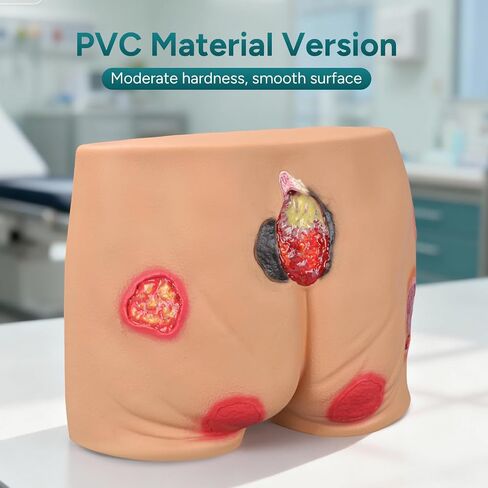 PVC Buttock Decubitus Ulcer Model, Pressure Ulcer Wound Care Model, Wound Care Education Tools for Teaching in Kuwait