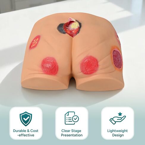 PVC Buttock Decubitus Ulcer Model, Pressure Ulcer Wound Care Model, Wound Care Education Tools for Teaching in Kuwait