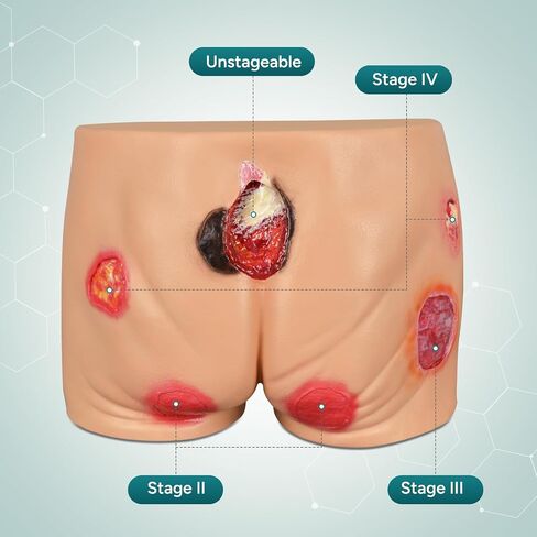 PVC Buttock Decubitus Ulcer Model, Pressure Ulcer Wound Care Model, Wound Care Education Tools for Teaching in Kuwait