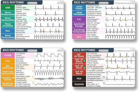 مجموعة بطاقات تفسير إيقاع EKG، مرجع ورقة الغش لإيقاع EKG للممرضات وأطباء الطوارئ والمسعفين الطبيين وطلاب الطب - شارة مقاومة للماء على الوجهين مع 24 إيقاعًا شائعًا للقلب in Kuwait
